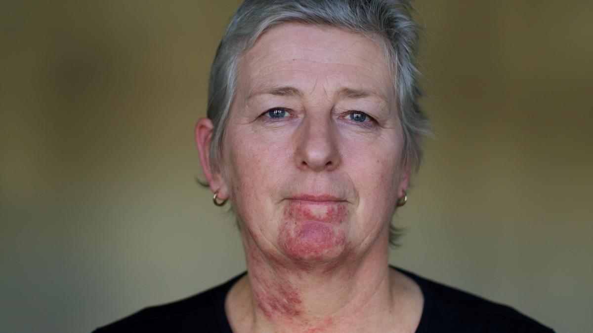 Image from the Channel 4 docuseries, Super Surgeons. A close-up photo of a woman, who is looking directly at the camera.